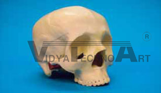 Skull, fractured, defect, Clips